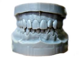 Dental Study Model Resin Material